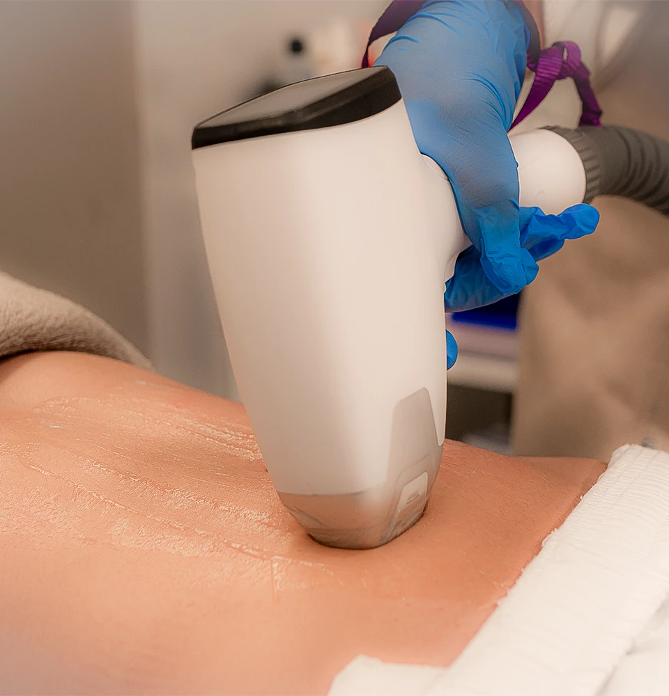 Epilazione laser definitiva a Savona Italian Beauty