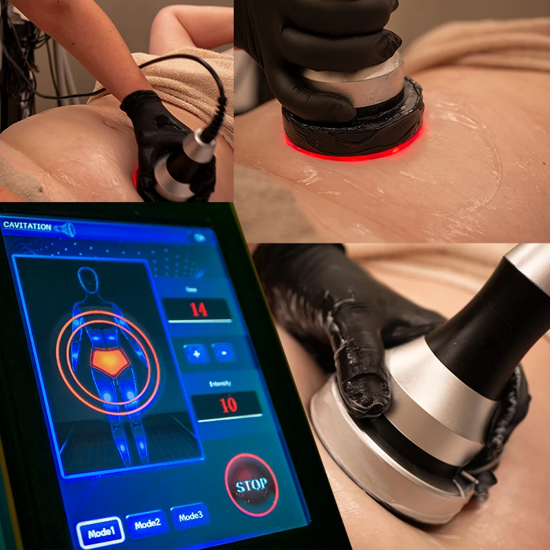 Trattamento Ultrasuoni Estetici a Savona