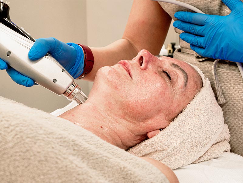 Trattamento viso IB Spheres Savona